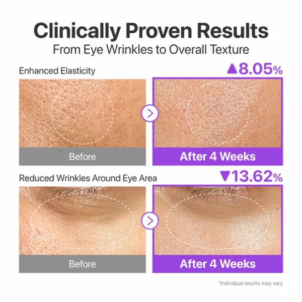 اسنس نامبوزین بایو لیفتینگ